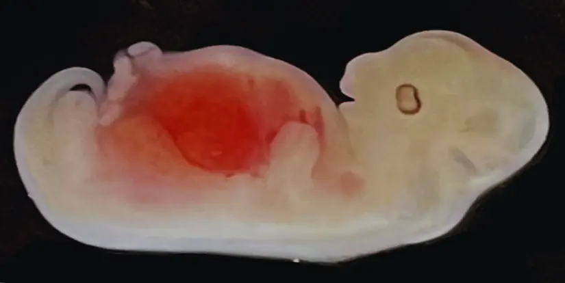 researchers-cultivate-humanized-kidneys-in-pig-embryos