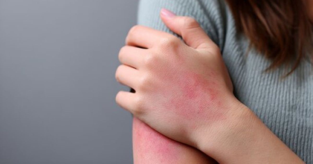 Doctors Explore Best Treatments for VEXAS Genetic Disorder