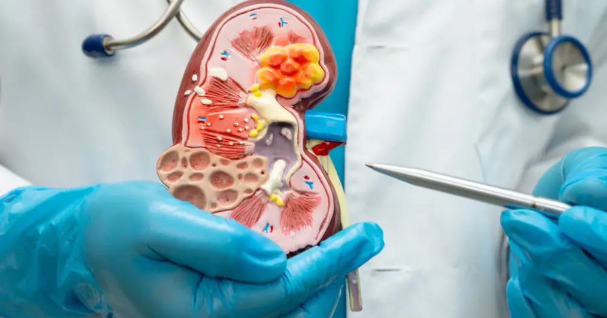 Kidney Transplant Recovery